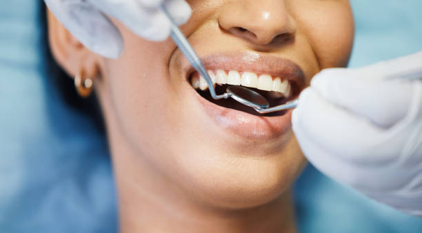 Laser Dentistry in Arbutus, MD